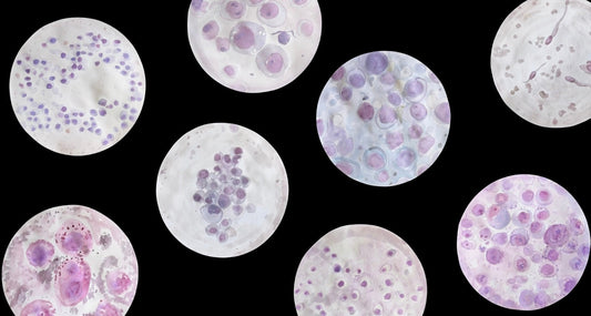Oncology
